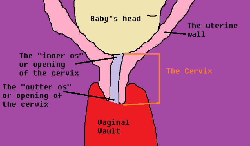 Mystery Cervix 2 - Copy